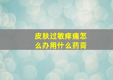 皮肤过敏痒痛怎么办用什么药膏