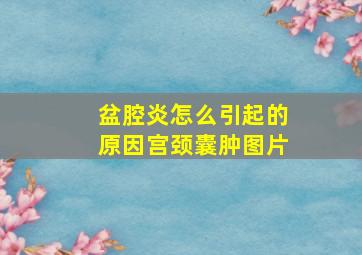 盆腔炎怎么引起的原因宫颈囊肿图片