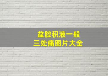 盆腔积液一般三处痛图片大全