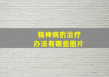 精神病的治疗办法有哪些图片