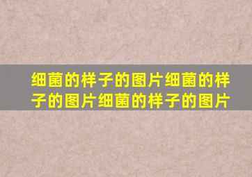 细菌的样子的图片细菌的样子的图片细菌的样子的图片