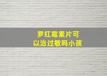 罗红霉素片可以治过敏吗小孩