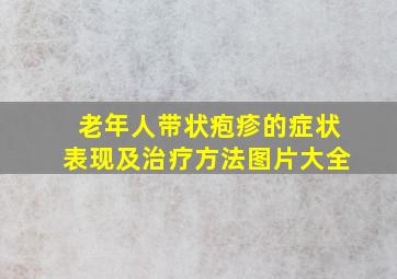 老年人带状疱疹的症状表现及治疗方法图片大全