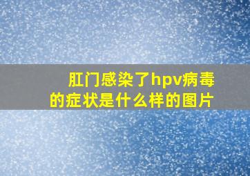 肛门感染了hpv病毒的症状是什么样的图片