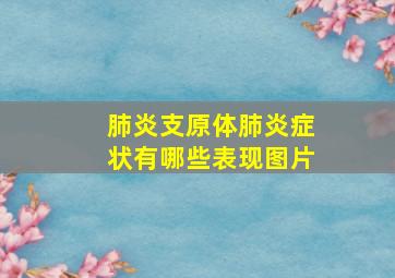 肺炎支原体肺炎症状有哪些表现图片