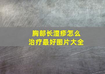 胸部长湿疹怎么治疗最好图片大全