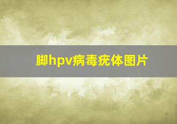 脚hpv病毒疣体图片