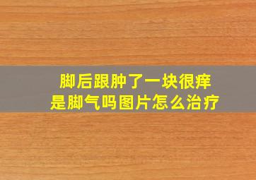 脚后跟肿了一块很痒是脚气吗图片怎么治疗