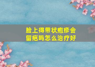 脸上得带状疱疹会留疤吗怎么治疗好