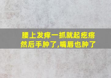 腰上发痒一抓就起疙瘩然后手肿了,嘴唇也肿了