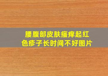 腰腹部皮肤瘙痒起红色疹子长时间不好图片