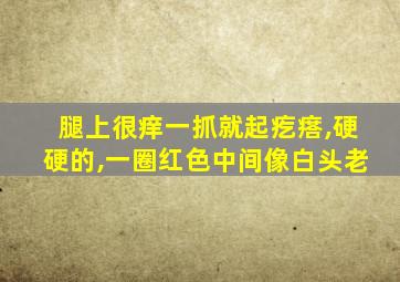 腿上很痒一抓就起疙瘩,硬硬的,一圈红色中间像白头老