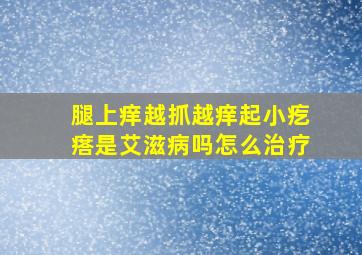 腿上痒越抓越痒起小疙瘩是艾滋病吗怎么治疗