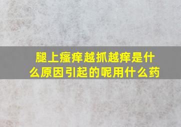 腿上瘙痒越抓越痒是什么原因引起的呢用什么药