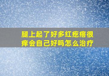 腿上起了好多红疙瘩很痒会自己好吗怎么治疗