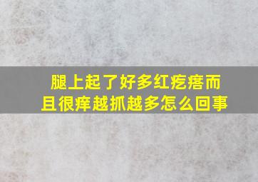 腿上起了好多红疙瘩而且很痒越抓越多怎么回事