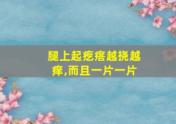 腿上起疙瘩越挠越痒,而且一片一片