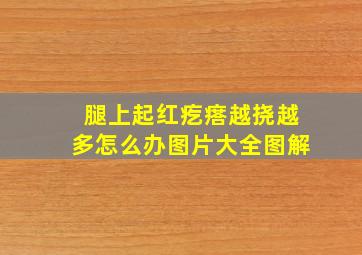 腿上起红疙瘩越挠越多怎么办图片大全图解