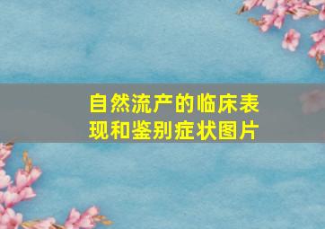 自然流产的临床表现和鉴别症状图片