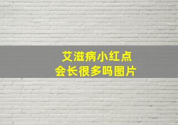 艾滋病小红点会长很多吗图片