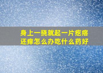 身上一挠就起一片疙瘩还痒怎么办吃什么药好