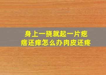 身上一挠就起一片疙瘩还痒怎么办肉皮还疼