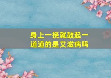 身上一挠就鼓起一道道的是艾滋病吗