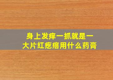 身上发痒一抓就是一大片红疙瘩用什么药膏