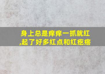 身上总是痒痒一抓就红,起了好多红点和红疙瘩