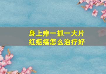 身上痒一抓一大片红疙瘩怎么治疗好