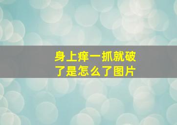 身上痒一抓就破了是怎么了图片