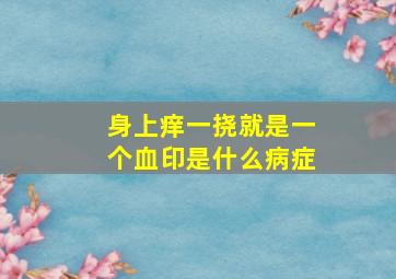 身上痒一挠就是一个血印是什么病症