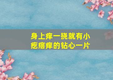 身上痒一挠就有小疙瘩痒的钻心一片