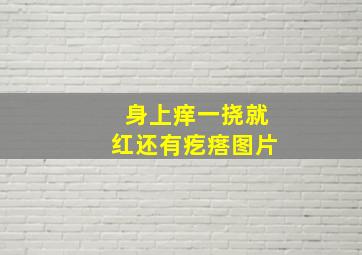 身上痒一挠就红还有疙瘩图片