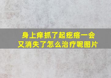 身上痒抓了起疙瘩一会又消失了怎么治疗呢图片