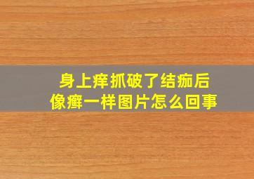 身上痒抓破了结痂后像癣一样图片怎么回事