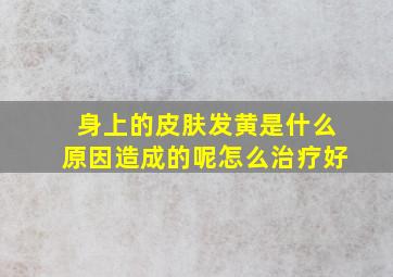 身上的皮肤发黄是什么原因造成的呢怎么治疗好