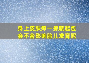 身上皮肤痒一抓就起包会不会影响胎儿发育呢