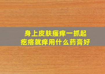 身上皮肤瘙痒一抓起疙瘩就痒用什么药膏好