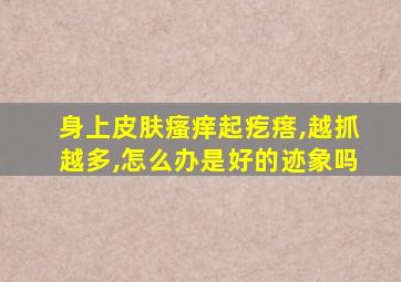 身上皮肤瘙痒起疙瘩,越抓越多,怎么办是好的迹象吗