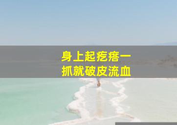 身上起疙瘩一抓就破皮流血