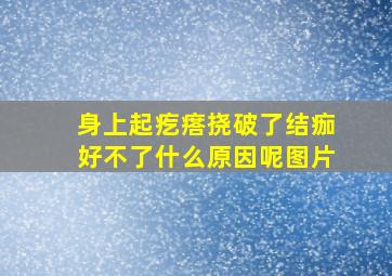 身上起疙瘩挠破了结痂好不了什么原因呢图片