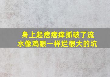 身上起疙瘩痒抓破了流水像鸡眼一样烂很大的坑