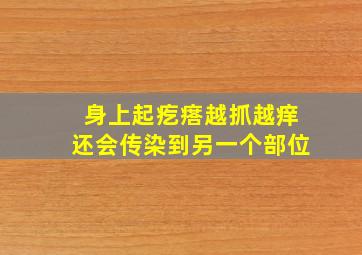 身上起疙瘩越抓越痒还会传染到另一个部位