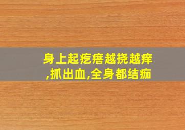 身上起疙瘩越挠越痒,抓出血,全身都结痂