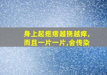 身上起疙瘩越挠越痒,而且一片一片,会传染