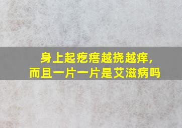 身上起疙瘩越挠越痒,而且一片一片是艾滋病吗