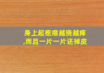 身上起疙瘩越挠越痒,而且一片一片还掉皮