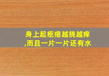 身上起疙瘩越挠越痒,而且一片一片还有水