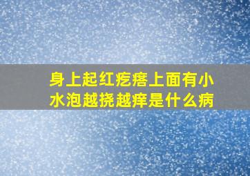 身上起红疙瘩上面有小水泡越挠越痒是什么病